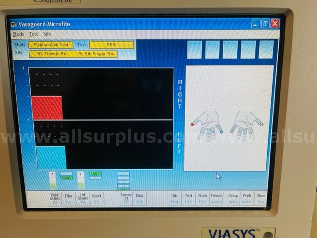 NICOLET VIASYS VASOGUARD MICROLITE EEG/EMG MACHINE (w797)  w797 Government Surplus Auction - Photo #6