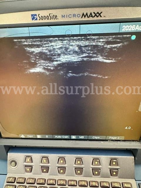 Sonosite MicroMaxx w/ 2 probes (C440)  C440 Government Surplus Auction - Photo #2