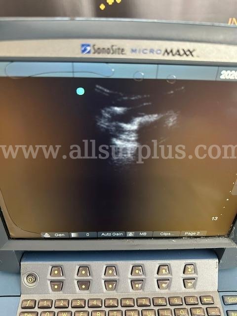 Sonosite MicroMaxx w/ 2 probes (C440)  C440 Government Surplus Auction - Photo #3